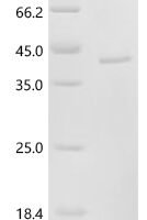 Human Granzyme K (GZMK) Recombinant Protein, N-His/C-His - BioCrest Sci