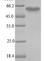 Mouse Interferon regulatory factor 3 (Irf3) Recombinant Protein, N-10His/C-Myc, aa 1–419, E.coli - BioCrest Sci