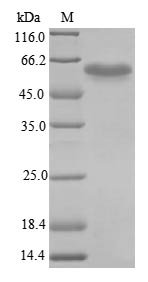 Mouse Interferon regulatory factor 3 (Irf3) Recombinant Protein, N-10His/C-Myc, aa 1–419, E.coli, Mus musculus (Mouse), E.coli, N-terminal 10xHis-tagged and C-terminal Myc-tagged, 51.9 kDa, purity >≥ 85% as determined by SDS-PAGE.