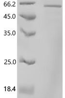 Human DnaJ homolog subfamily B member 6 (DNAJB6) Recombinant Protein, C-hFc1 - BioCrest Sci