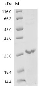 Human Growth/differentiation factor 8 (MSTN) Recombinant Protein, C-10His, Mature, Homo sapiens (Human), E.coli, C-terminal 10xHis-tagged, 22.2 kDa, purity >≥ 90% as determined by SDS-PAGE.