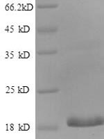 Human CCAAT/enhancer-binding protein gamma (CEBPG), partial Recombinant Protein - BioCrest Sci