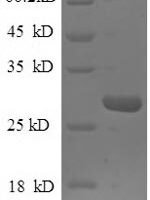 Human Epiplakin (EPPK1), partial Recombinant Protein - BioCrest Sci