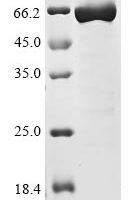 Influenza A virus Nucleoprotein (NP) (X477S) Recombinant Protein - BioCrest Sci