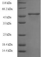 Juniperus ashei Pectate lyase 1 Recombinant Protein, N-His-SUMO - BioCrest Sci