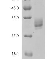 Rat Oncostatin-M (Osm) Recombinant Protein - BioCrest Sci