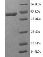 Human Fibroblast growth factor receptor 3 (FGFR3 IIIc), partial Recombinant Protein, N-His, aa 23–375, Yeast - BioCrest Sci