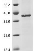 Plasmodium malariae Merozoite surface protein 1 (MSP1), partial Recombinant Protein - BioCrest Sci