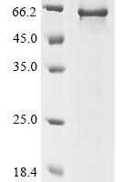 Human Charged multivesicular body protein 7 (CHMP7) Recombinant Protein - BioCrest Sci