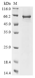 Human Charged multivesicular body protein 7 (CHMP7) Recombinant Protein, Homo sapiens (Human), E.coli, N-terminal 6xHis-tagged, 56.9 kDa, purity >≥ 85% as determined by SDS-PAGE.