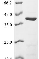 Human HLA class I histocompatibility antigen, B alpha chain (HLA-B), partial Recombinant Protein - BioCrest Sci