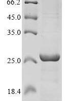Human Excitatory amino acid transporter 1 (SLC1A3), partial Recombinant Protein, N-His-KSI - BioCrest Sci