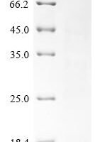 Naja atra Cytotoxin 3b Recombinant Protein - BioCrest Sci