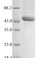 Plasmodium falciparum VAR2CSA DBL5 Recombinant Protein - BioCrest Sci