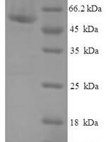 Human Probable cytosolic iron-sulfur protein assembly protein CIAO1 (CIAO1) Recombinant Protein - BioCrest Sci