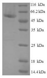 Human Probable cytosolic iron-sulfur protein assembly protein CIAO1 (CIAO1) Recombinant Protein, Homo sapiens (Human), E.coli, N-terminal 6xHis-SUMO-tagged, 53.8 kDa, purity >≥ 90% as determined by SDS-PAGE.