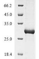Mouse C-type lectin domain family 4 member G (Clec4g), partial Recombinant Protein - BioCrest Sci