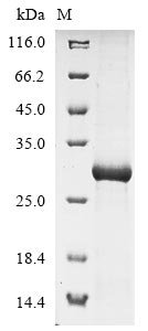 Mouse C-type lectin domain family 4 member G (Clec4g), partial Recombinant Protein, Mus musculus (Mouse), E.coli, N-terminal 6xHis-tagged, 31.1 kDa, purity >≥ 85% as determined by SDS-PAGE.