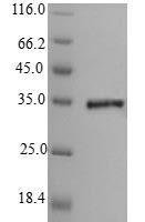 Clostridium botulinum  Penicillin-binding protein 1A (pbpA),Partial Recombinant Protein - BioCrest Sci