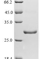 Schistosoma japonicum Glutathione S-transferase class-mu 26 kDa isozyme Recombinant Protein - BioCrest Sci