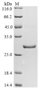 Schistosoma japonicum Glutathione S-transferase class-mu 26 kDa isozyme Recombinant Protein, Schistosoma japonicum (Blood fluke), Yeast, N-terminal 6xHis-tagged, 30.4 kDa, purity >≥ 90% as determined by SDS-PAGE.