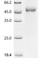 Human Thrombopoietin (THPO) Recombinant Protein - BioCrest Sci