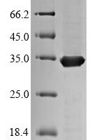 Mycobacterium tuberculosis Diacylglycerol acyltransferase/mycolyltransferase Ag85C (fbpC) Recombinant Protein - BioCrest Sci