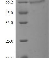 Human Tyrosine-protein kinase receptor UFO (AXL) (D266N), partial Recombinant Protein, C-10His - BioCrest Sci