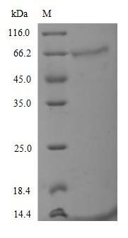 Human Tyrosine-protein kinase receptor UFO (AXL) (D266N), partial Recombinant Protein, C-10His, Homo sapiens (Human), Mammalian cell, C-terminal 10xHis-tagged, 48.9 kDa, purity >≥ 90% as determined by SDS-PAGE.