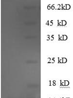 Human CCL5/RANTES Recombinant Protein, N-His - BioCrest Sci