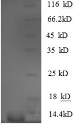 Human CCL5/RANTES Recombinant Protein, N-His, Homo sapiens (Human), E.coli, N-terminal 6xHis-tagged, 11.9 kDa, purity >≥ 90% as determined by SDS-PAGE.