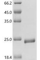 Human papillomavirus 68 Protein E7 (E7) Recombinant Protein - BioCrest Sci