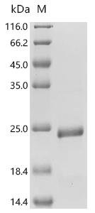 Human papillomavirus 68 Protein E7 (E7) Recombinant Protein, Human papillomavirus 68, E.coli, C-terminal 6xHis-tagged, 19.7 kDa, purity >≥ 95% as determined by SDS-PAGE.