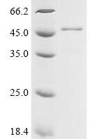 Arabidopsis thaliana Chlorophyllase-1 (CLH1) Recombinant Protein - BioCrest Sci