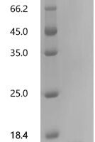 Bovine Transthyretin (TTR) Recombinant Protein, C-His, aa 21–147, Bos taurus (Bovine), Purity ≥95% - BioCrest Sci
