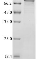Human Protein lin-28 homolog A (LIN28A) Recombinant Protein, N-His-PDI - BioCrest Sci
