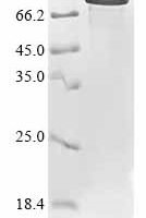 Human Wee1-like protein kinase (WEE1) Recombinant Protein, N-His - BioCrest Sci