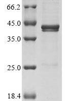 Vaccinia virus Protein A56 (HA), partial Recombinant Protein - BioCrest Sci