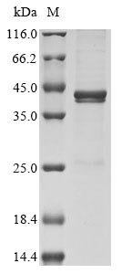 Vaccinia virus Protein A56 (HA), partial Recombinant Protein, Vaccinia virus (strain Copenhagen) (VACV), E.coli, N-terminal 6xHis-tagged, 31.6 kDa, purity >≥ 85% as determined by SDS-PAGE.