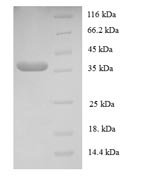 Human Transcription initiation factor IIE subunit beta (GTF2E2) Recombinant Protein - BioCrest Sci