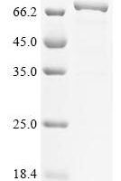 Human Myosin-6 (MYH6), partial,Biotinylated Recombinant Protein - BioCrest Sci