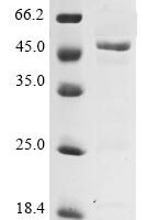 Avian infectious bronchitis virus Nucleoprotein (N) Recombinant Protein, C-His, aa 1–409, strain KB8523, E.coli - BioCrest Sci