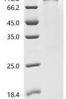 Pseudoalteromonas carrageenovora Lambda-carrageenase (cglA) Recombinant Protein - BioCrest Sci