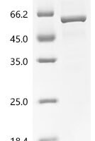 Human Glucose-6-phosphate 1-dehydrogenase (G6PD) Recombinant Protein - BioCrest Sci