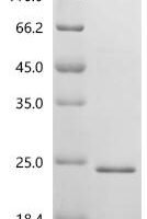 Human Organic cation/carnitine transporter 2 (SLC22A5), partial Recombinant Protein - BioCrest Sci