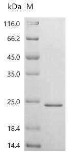 Human Organic cation/carnitine transporter 2 (SLC22A5), partial Recombinant Protein, Homo sapiens (Human), E.coli, C-terminal 6xHis-tagged, 18.4 kDa, purity >≥ 95% as determined by SDS-PAGE.