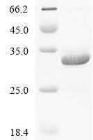 N-terminal hFc1-tagged Recombinant Protein - BioCrest Sci