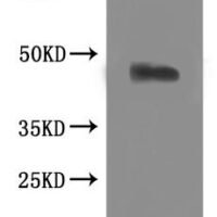 Macaca mulatta C-C chemokine receptor type 8 (CCR8)-VLPs Recombinant Protein - BioCrest Sci