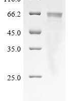 Rat Angiopoietin-1 (Angpt1) Recombinant Protein, C-His, aa 20–497, Baculovirus - BioCrest Sci