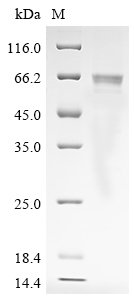 Rat Angiopoietin-1 (Angpt1) Recombinant Protein, C-His, aa 20–497, Baculovirus, Rattus norvegicus (Rat), Baculovirus, C-terminal 6xHis-tagged, 58.9 kDa, purity >≥ 85% as determined by SDS-PAGE.